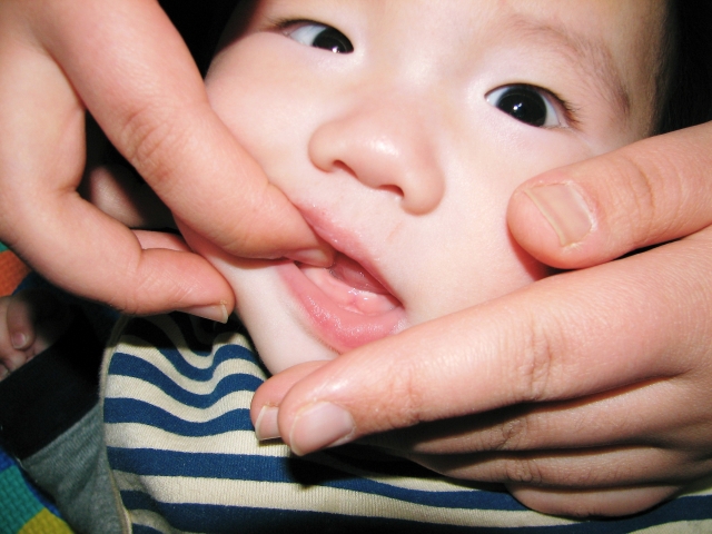 赤ちゃんが歯ぎしりするのは悪影響？原因や歯並びへの影響を調査！